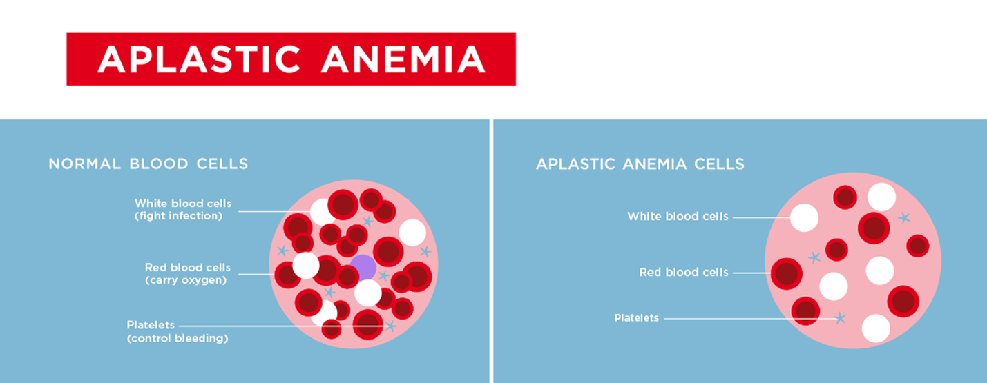 A diagram of anemia

Description automatically generated