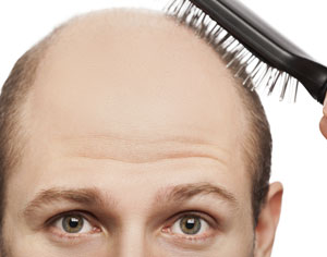 Half Bald man holding a comb